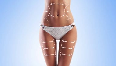 Yağ kaybetmek, liposuction, spor, fitness, sağlıklı beslenme, beslenme, uygun şekil ve selülit kaldırma kavramı. Kadın vücudunda oklarla.