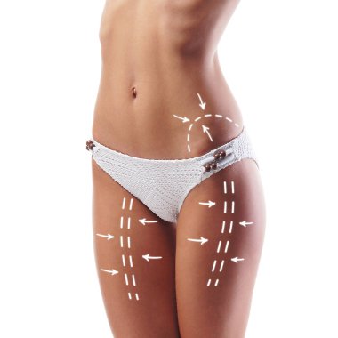 Kadınlar mayo oklar onu mide ve bacak boyunca sahip gövdesinde ince. Yağ kaybetmek, liposuction ve selülit kaldırma kavramı.