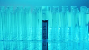 Kan ve virüslü laboratuvar tüpleri. Hastanedeki bilimsel laboratuvara yakın çekim. Salgın hastalıklar, sağlık hizmetleri, aşı araştırmaları ve Coronavirus 2019-ncov test konsepti.