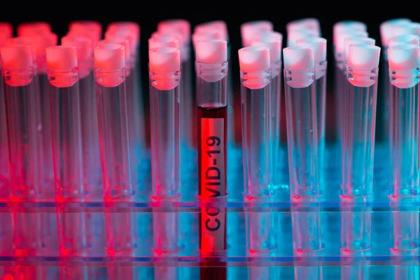 Riadó Laborban Tudományos Labor Közelkép Pandémiás Betegség Egészségügyi Ellátás Vakcinakutatás — Stock Fotó