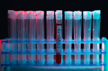 Laboratuvarda alarm. Bilimsel laboratuvar yakın plan. Salgın hastalıklar, sağlık hizmetleri, aşı araştırmaları ve Coronavirus covid-19 test konsepti.