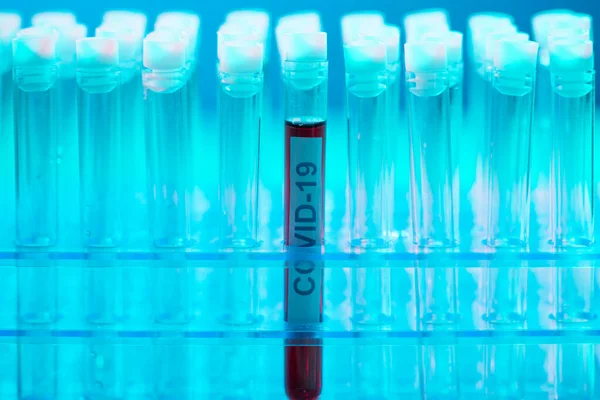 Εργαστηριακός Σωλήνας Αίμα Και Επιστημονικό Εργαστήριο Από Κοντά Πανδημική Νόσος — Φωτογραφία Αρχείου