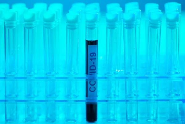 Laborröhrchen Mit Blut Und Virus Wissenschaftliche Labor Nahaufnahme Pandemie Gesundheitswesen — Stockfoto