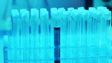 Kan ve virüslü laboratuvar tüpü. Bilimsel laboratuvar yakın plan. Salgın hastalıklar, sağlık hizmetleri, aşı araştırmaları ve Coronavirus covid-19 test konsepti.