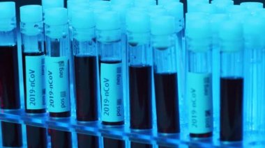 Kan ve virüslü laboratuvar tüpleri. Hastanedeki bilimsel laboratuvara yakın çekim. Salgın hastalıklar, sağlık hizmetleri, aşı araştırmaları ve Coronavirus 2019-ncov test konsepti.