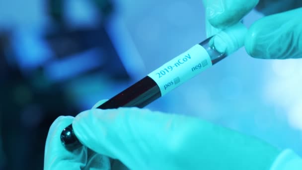 Blod Och Virus Laboratorietuben Närbild Vetenskapligt Labb Kliniker Pandemisk Sjukdom — Stockvideo