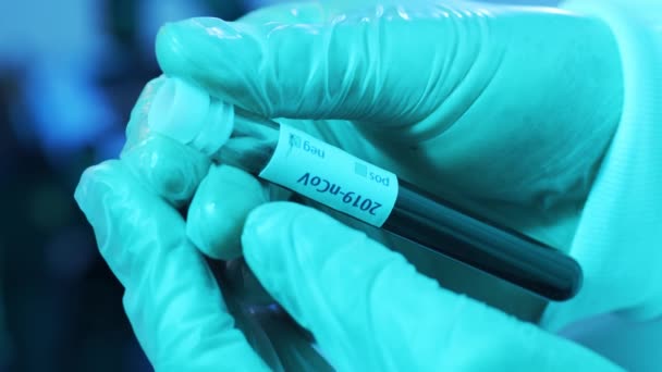 Laboratory Tubes Blood Virus Close Scientific Lab Hospital Epidemic Disease Stock Footage