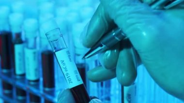 Kan ve virüslü laboratuvar tüpleri. Hastanedeki bilimsel laboratuvara yakın çekim. Salgın hastalıklar, sağlık hizmetleri, aşı araştırmaları ve Coronavirus 2019-ncov test konsepti.