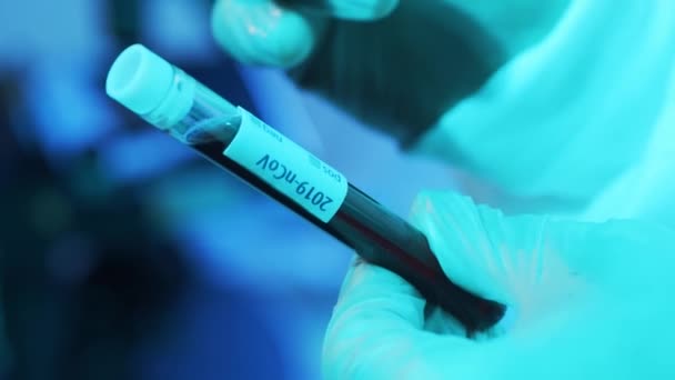 Лабораторные Трубки Кровью Вирусом Крупный План Научной Лаборатории Больнице Эпидемические — стоковое видео