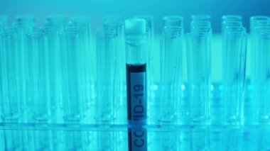 Kan ve virüslü laboratuvar tüpleri. Hastanedeki bilimsel laboratuvara yakın çekim. Salgın hastalıklar, sağlık hizmetleri, aşı araştırmaları ve Coronavirus 2019-ncov test konsepti.