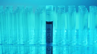 Kan ve virüslü laboratuvar tüpü. Bilimsel laboratuvar yakın plan. Salgın hastalıklar, sağlık hizmetleri, aşı araştırmaları ve Coronavirus covid-19 test konsepti.