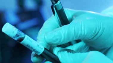 Laboratuvar tüpünde kan ve virüs var. Kliniklerdeki bilimsel laboratuvara yakın çekim. Salgın hastalıklar, sağlık hizmetleri, aşı araştırmaları ve Coronavirus covid-19 test konsepti.