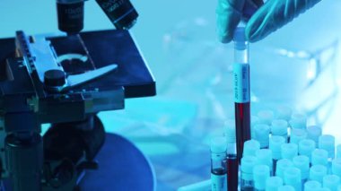 Kan ve virüslü laboratuvar tüpleri. Hastanedeki bilimsel laboratuvara yakın çekim. Salgın hastalıklar, sağlık hizmetleri, aşı araştırmaları ve Coronavirus 2019-ncov test konsepti.