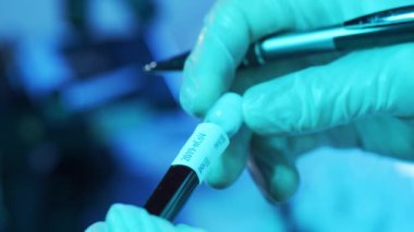 Kan ve virüslü laboratuvar tüpleri. Hastanedeki bilimsel laboratuvara yakın çekim. Salgın hastalıklar, sağlık hizmetleri, aşı araştırmaları ve Coronavirus 2019-ncov test konsepti.