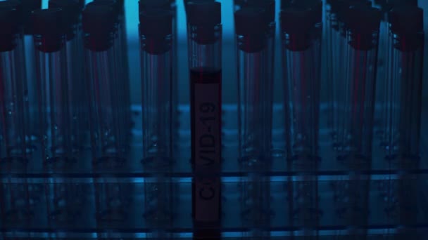在实验室发出警报医院科学实验室的特写镜头 流行病 疫苗研究和2019 Ncov病毒检测概念 — 图库视频影像