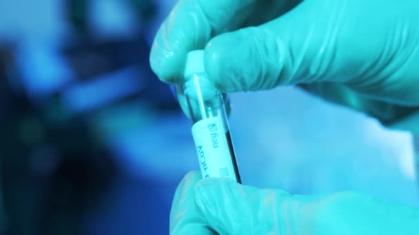 Blut Und Virus Laborrohr Nahaufnahme Des Wissenschaftlichen Labors Kliniken Pandemie — Stockvideo