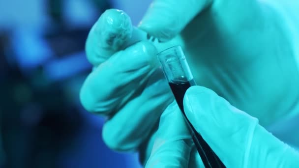 바이러스가 실험실 병원에 실험실을 클로즈업했습니다 전염병 코로나 바이러스 2019 Ncov — 비디오