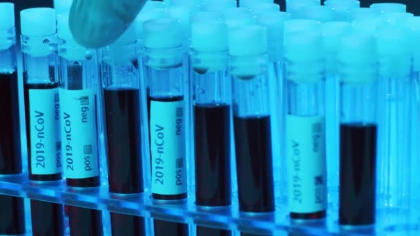 Blod Och Virus Laboratorietuben Närbild Vetenskapligt Labb Kliniker Pandemisk Sjukdom — Stockvideo