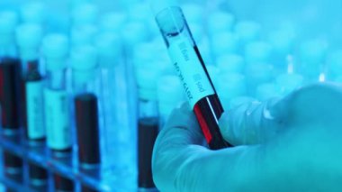 Laboratuvar tüpünde kan ve virüs var. Kliniklerdeki bilimsel laboratuvara yakın çekim. Salgın hastalıklar, sağlık hizmetleri, aşı araştırmaları ve Coronavirus covid-19 test konsepti.