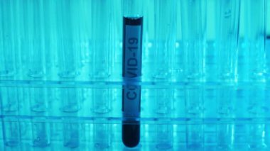 Kan ve virüslü laboratuvar tüpü. Bilimsel laboratuvar yakın plan. Salgın hastalıklar, sağlık hizmetleri, aşı araştırmaları ve Coronavirus covid-19 test konsepti.