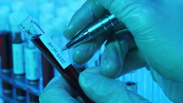 Tubos Laboratorio Con Sangre Virus Primer Plano Del Laboratorio Científico — Vídeos de Stock