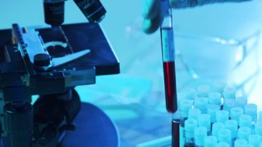 Kan ve virüslü laboratuvar tüpleri. Hastanedeki bilimsel laboratuvara yakın çekim. Salgın hastalıklar, sağlık hizmetleri, aşı araştırmaları ve Coronavirus 2019-ncov test konsepti.