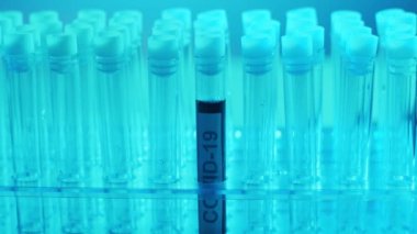 Kan ve virüslü laboratuvar tüpleri. Hastanedeki bilimsel laboratuvara yakın çekim. Salgın hastalıklar, sağlık hizmetleri, aşı araştırmaları ve Coronavirus 2019-ncov test konsepti.