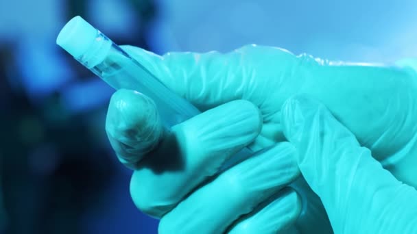 Laboratóriumi Csövek Vérrel Vírussal Egy Közeli Kép Tudományos Laborról Kórházban — Stock videók