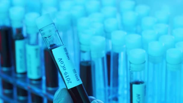 研究室の管の血液とウイルス 診療所の科学研究室の閉鎖 流行病 ワクチン研究とコロナウイルス Covid 19テストコンセプト — ストック動画