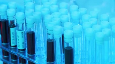 Kan ve virüslü laboratuvar tüpleri. Hastanedeki bilimsel laboratuvara yakın çekim. Salgın hastalıklar, sağlık hizmetleri, aşı araştırmaları ve Coronavirus 2019-ncov test konsepti.