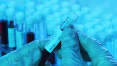 Laboratuvar tüpünde kan ve virüs var. Kliniklerdeki bilimsel laboratuvara yakın çekim. Salgın hastalıklar, sağlık hizmetleri, aşı araştırmaları ve Coronavirus covid-19 test konsepti.