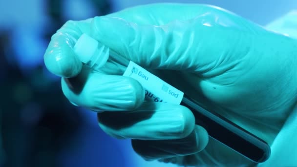 Кров Вірус Лабораторній Трубці Крупним Планом Наукова Лабораторія Клініках Пандемічна — стокове відео