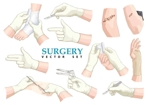 Las manos quirúrgicas. Conjunto de vectores . — Archivo Imágenes Vectoriales