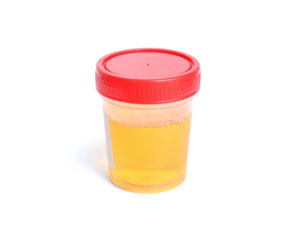 Behållare med urin för analys. Isolerade.. — Stockfoto