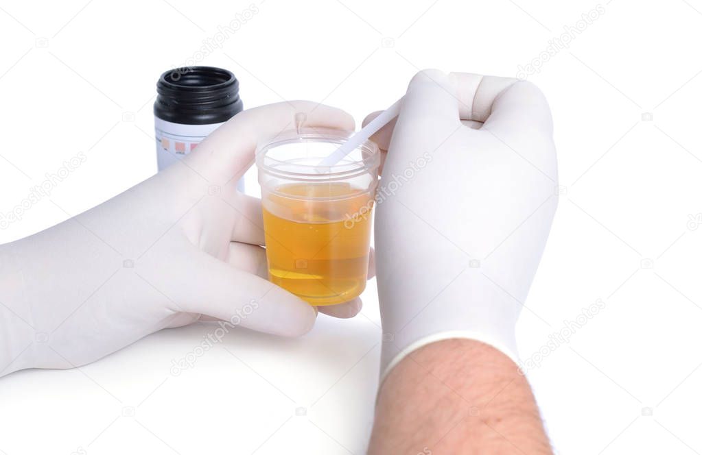 The laboratory assistant investigates urine from test strips. Is