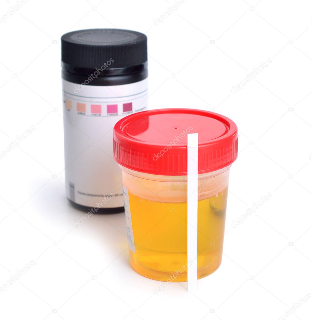 Container with urine and test-strips for the analysis. Isolated.