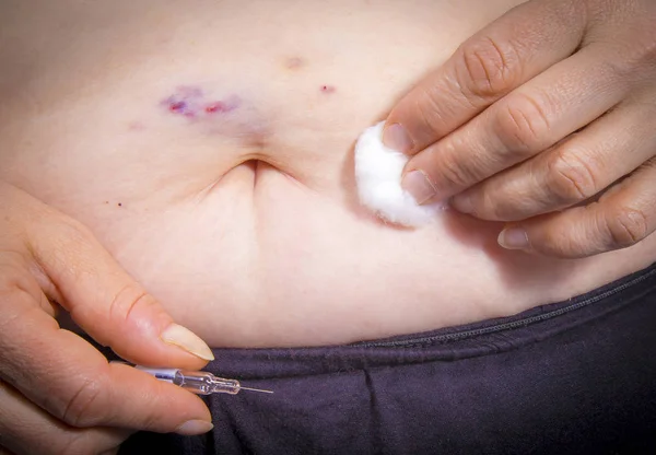 Bruises from self Injecting medical therapy — Stock Photo, Image