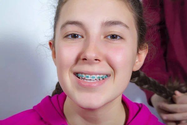 Smiling teenage girl with teeth braces — Stock Photo, Image