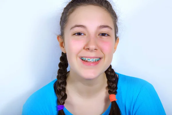 Sonriente adolescente con los dientes frenos — Foto de Stock