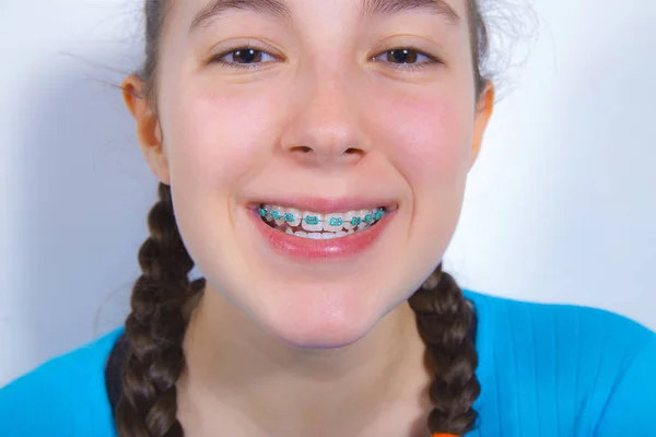 Diş diş telleri ile gülümseyen genç kız — Stok fotoğraf