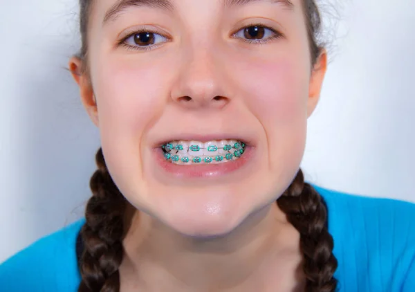 Shemales with braces on teeth