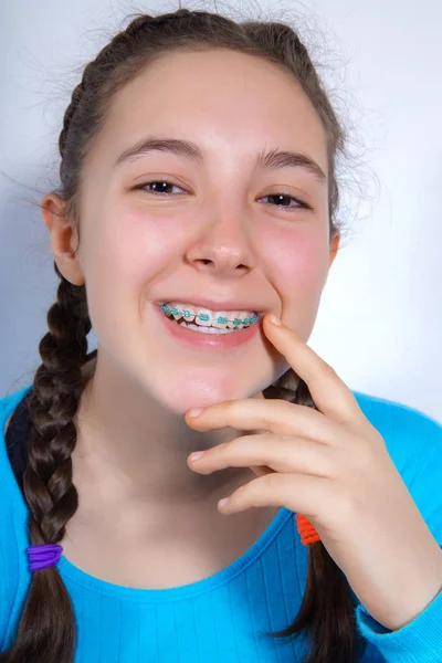 Sorrindo adolescente com aparelho de dentes — Fotografia de Stock