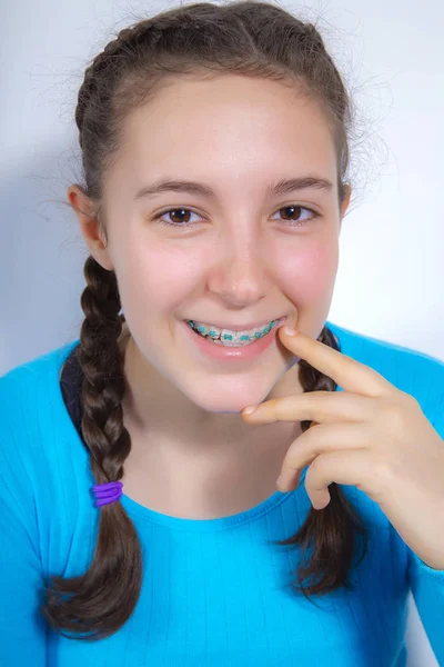 Sonriente adolescente con los dientes frenos — Foto de Stock