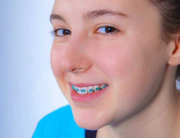 Smiling teenage girl with teeth braces — Stock Photo, Image