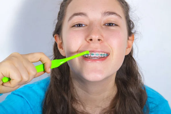 Усміхнена дівчина-підліток з зубними брекетами — стокове фото