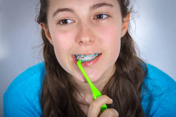 Sorrindo adolescente com aparelho de dentes — Fotografia de Stock