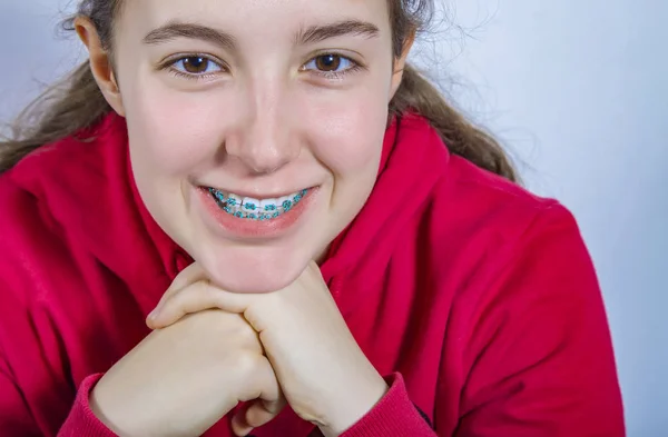 Улыбающаяся девочка-подросток с брекетами на зубах — стоковое фото