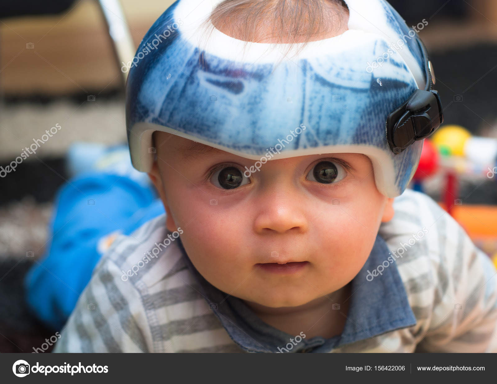 Child in an orthopedic helmet Stock Photo by ©Kalmot 156422006