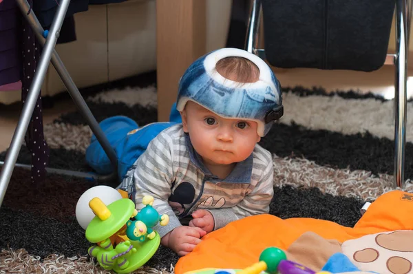 Criança em um capacete ortopédico Fotografias De Stock Royalty-Free
