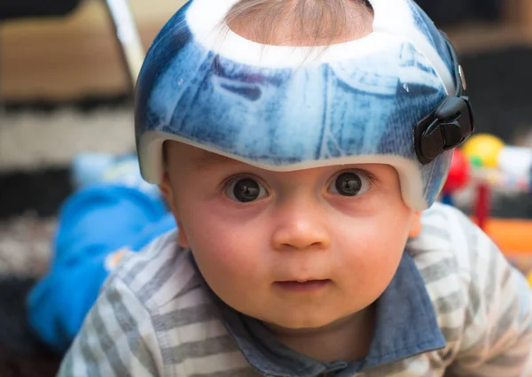 Child in an orthopedic helmet Stock Photo